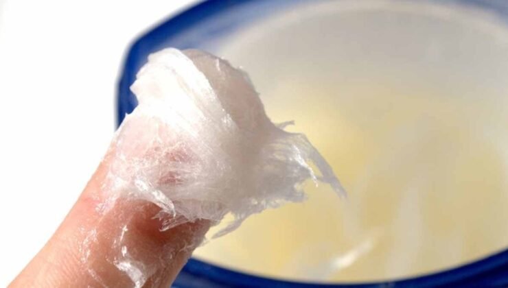 An Interesting Call From Russia: Stock Up on Vaseline!